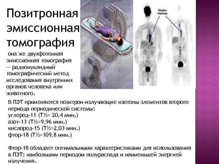 Позитронная эмиссионная томография она же двухфотонная эмиссионная томография — радионуклидный томографический метод исследования внутренних