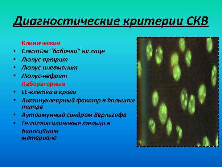 Диагностические критерии СКВ • • Клинические СИМПТОМ "бабочки" на лице Люпус-артрит Люпус-пневмонит Люпус-нефрит Лабораторные