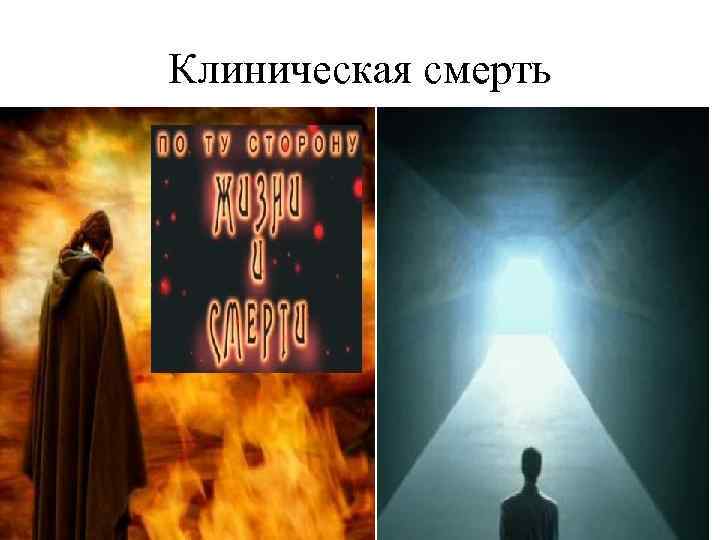 Клиническая смерть 