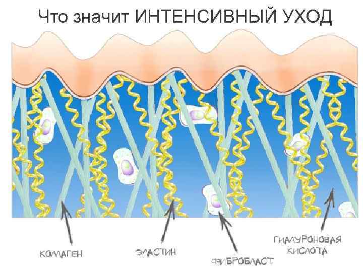 Что значит ИНТЕНСИВНЫЙ УХОД 