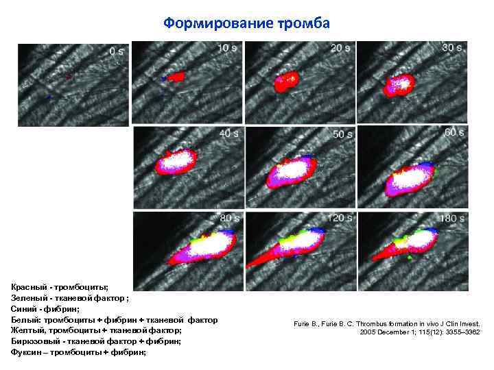 Формирование тромба Красный - тромбоциты; Зеленый - тканевой фактор ; Синий - фибрин; Белый: