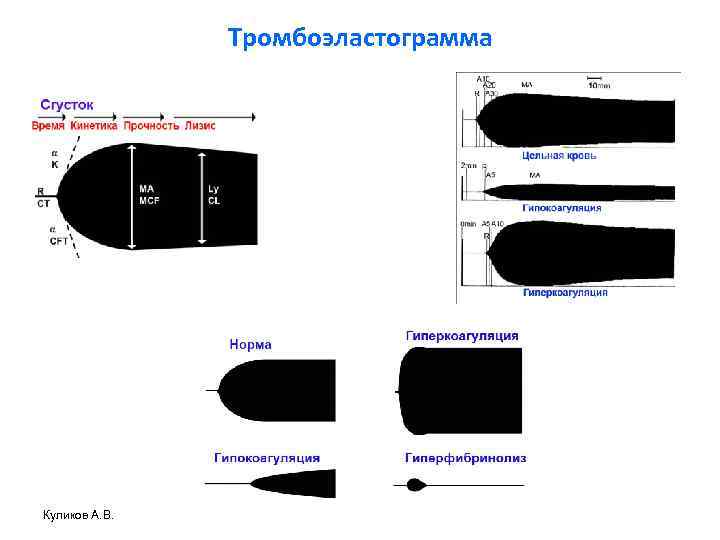 Тромбоэластограмма Куликов А. В. 