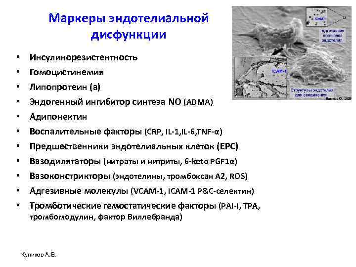 Маркеры эндотелиальной дисфункции • • • Инсулинорезистентность Гомоцистинемия Липопротеин (а) Эндогенный ингибитор синтеза NO