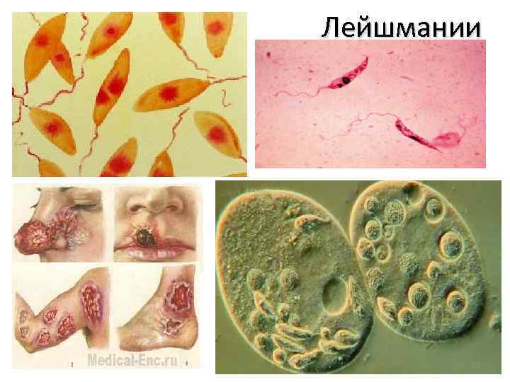 Строение лейшмания рисунок