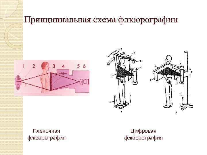 Принципиальная схема флюорографии Пленочная флюорография Цифровая флюорография 