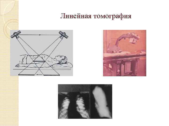 Линейная томография 