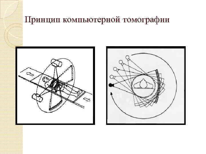 Принцип компьютерной томографии 