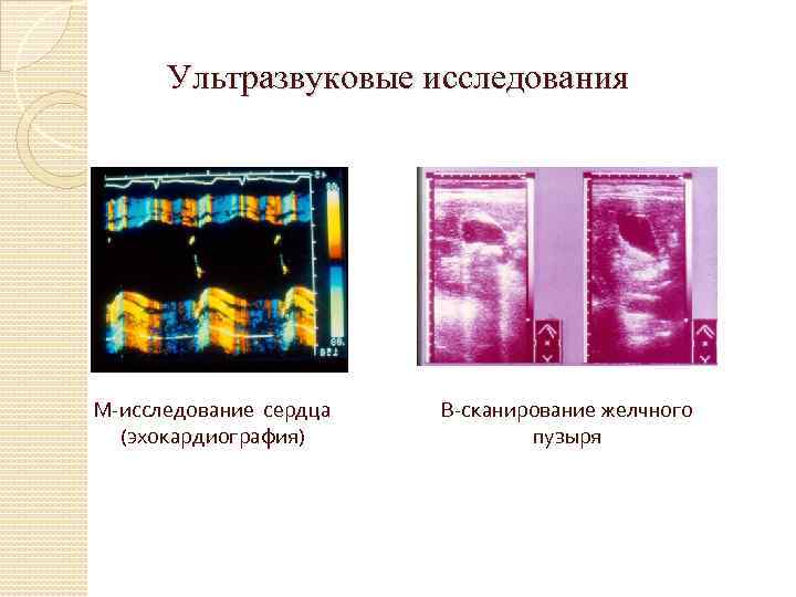 Ультразвуковые исследования М-исследование сердца (эхокардиография) В-сканирование желчного пузыря 