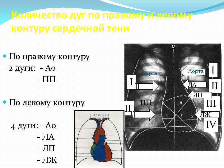 Количество дуг по правому и левому контуру сердечной тени По правому контуру 2 дуги: