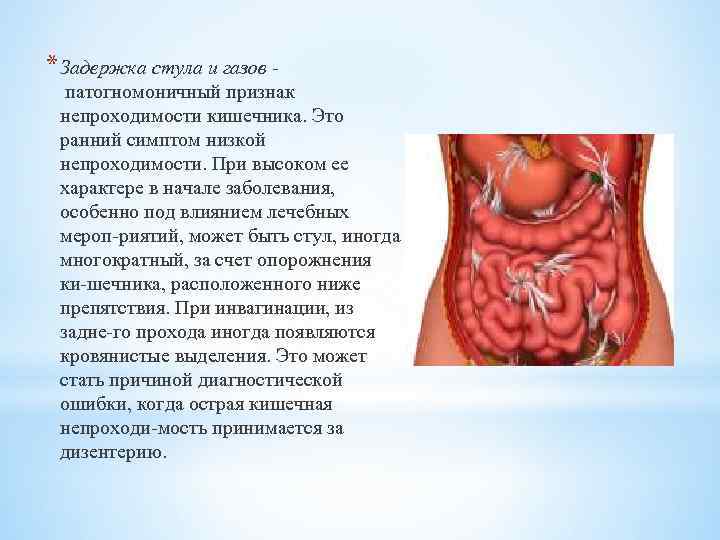 * Задержка стула и газов патогномоничный признак непроходимости кишечника. Это ранний симптом низкой непроходимости.