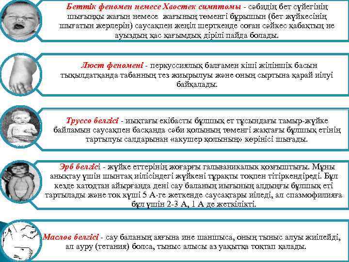 Беттік феномен немесе Хвостек симптомы - сәбидің бет сүйегінің шығыңқы жағын немесе жағының төменгі