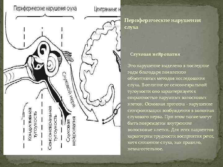 Периферические нарушения слуха Слуховая нейропатия Это нарушение выделено в последние годы благодаря появлению объективных