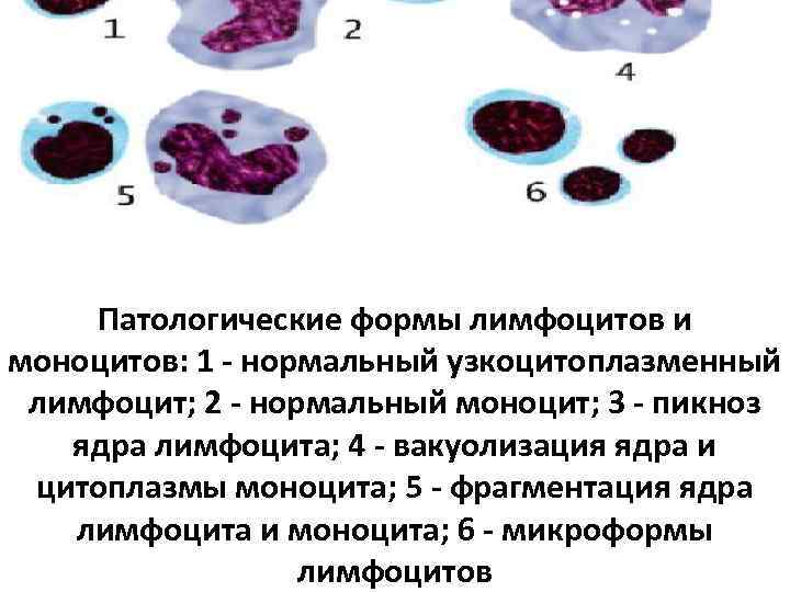 Формы ядер лейкоцитов