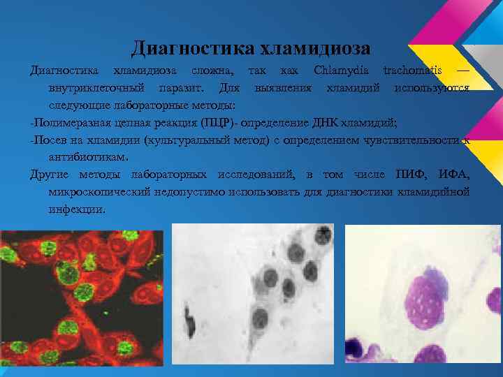 Диагностика хламидиоза сложна, так как Chlamydia trachomatis — внутриклеточный паразит. Для выявления хламидий используются