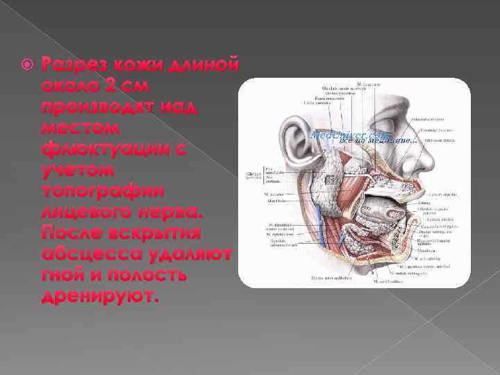  Разрез кожи длиной около 2 см производят над местом флюктуации с учетом топографии