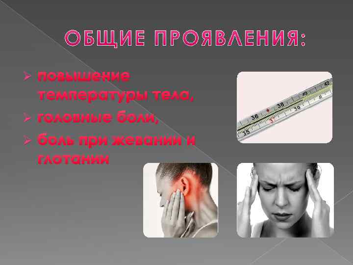 повышение температуры тела, Ø головные боли, Ø боль при жевании и глотании Ø 