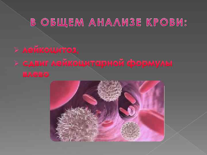 В ОБЩЕМ АНАЛИЗЕ КРОВИ: лейкоцитоз, Ø сдвиг лейкоцитарной формулы влево Ø 