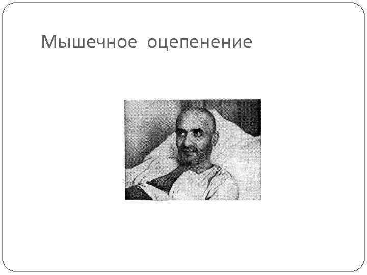 Мышечное оцепенение 