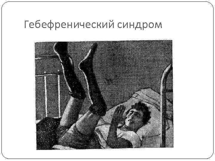 Гебефренический синдром 