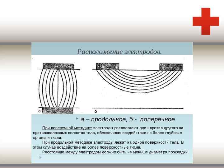 Продольное расположение. Что такое продольная методика расположения электродов?. Поперечное и продольное расположение электродов. Поперечное расположение электродов. Поперечная методика электрофореза.