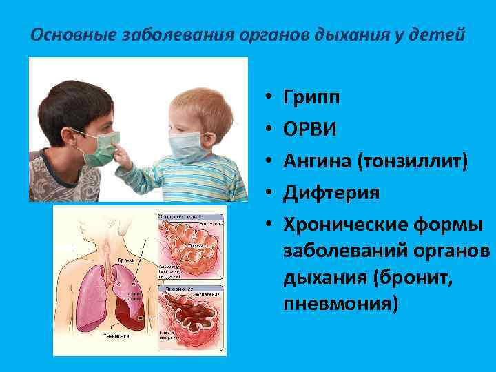 Основные заболевания органов дыхания у детей • • • Грипп ОРВИ Ангина (тонзиллит) Дифтерия