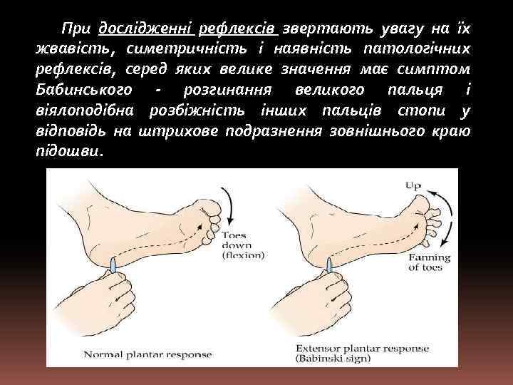 При дослідженні рефлексів звертають увагу на їх жвавість, симетричність і наявність патологічних рефлексів, серед