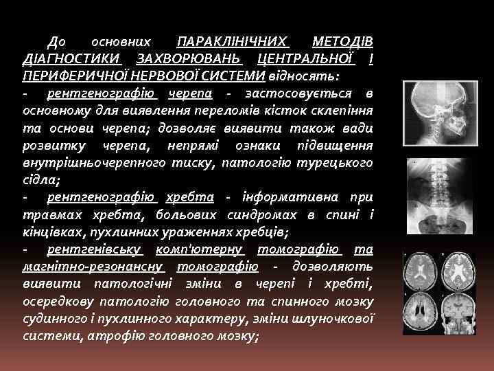 До основних ПАРАКЛІНІЧНИХ МЕТОДІВ ДІАГНОСТИКИ ЗАХВОРЮВАНЬ ЦЕНТРАЛЬНОЇ І ПЕРИФЕРИЧНОЇ НЕРВОВОЇ СИСТЕМИ відносять: - рентгенографію