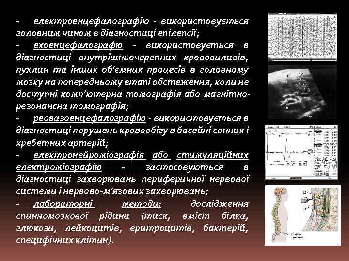 - електроенцефалографію - використовується головним чином в діагностиці епілепсії; - ехоенцефалографю - використовується в