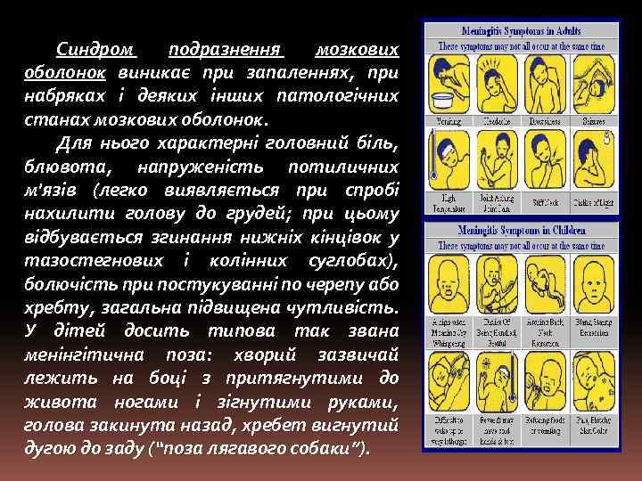 Синдром подразнення мозкових оболонок виникає при запаленнях, при набряках і деяких інших патологічних станах