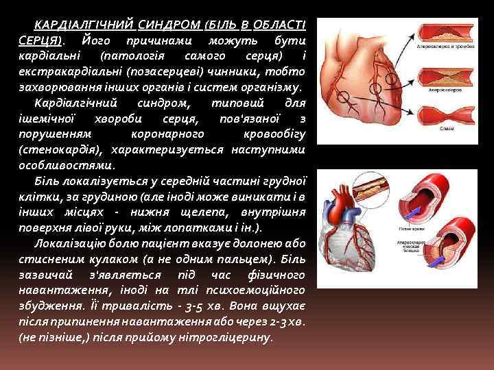 КАРДІАЛГІЧНИЙ СИНДРОМ (БІЛЬ В ОБЛАСТІ СЕРЦЯ). Його причинами можуть бути кардіальні (патологія самого серця)