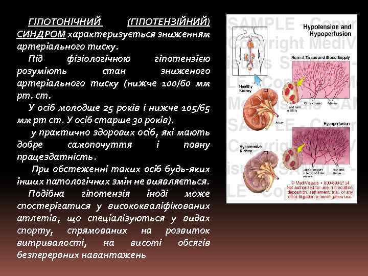 ГІПОТОНІЧНИЙ (ГІПОТЕНЗІЙНИЙ) СИНДРОМ характеризується зниженням артеріального тиску. Під фізіологічною гіпотензією розуміють стан зниженого артеріального