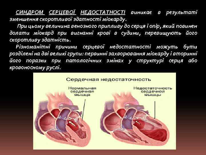 СИНДРОМ СЕРЦЕВОЇ НЕДОСТАТНОСТІ виникає в результаті зменшення скоротливої здатності міокарду. При цьому величина венозного