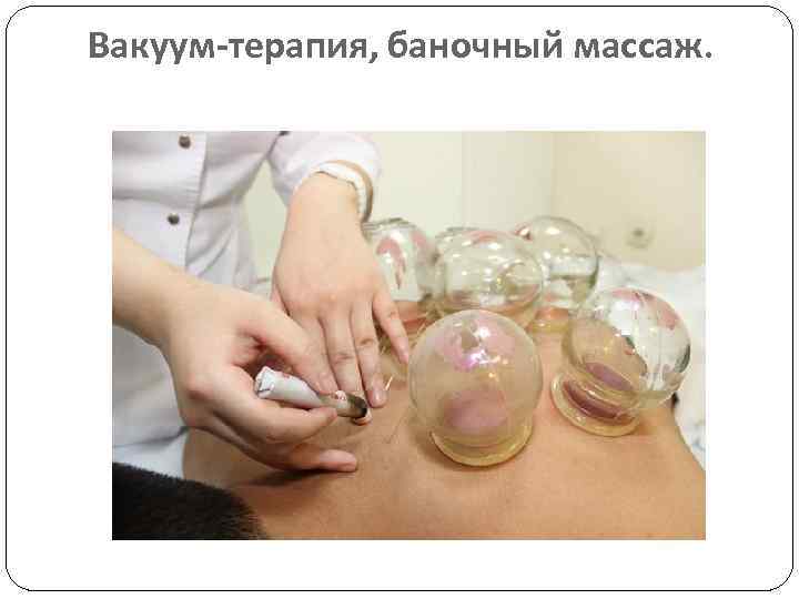  Вакуум-терапия, баночный массаж. 