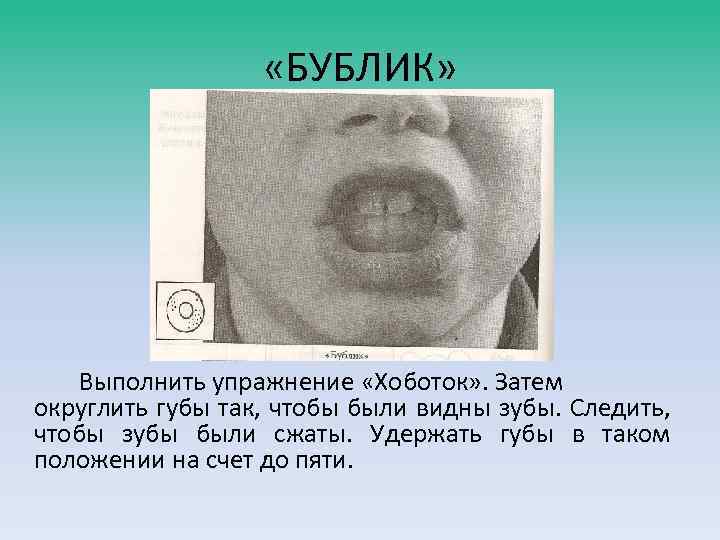  «БУБЛИК» Выполнить упражнение «Хоботок» . Затем округлить губы так, чтобы были видны зубы.