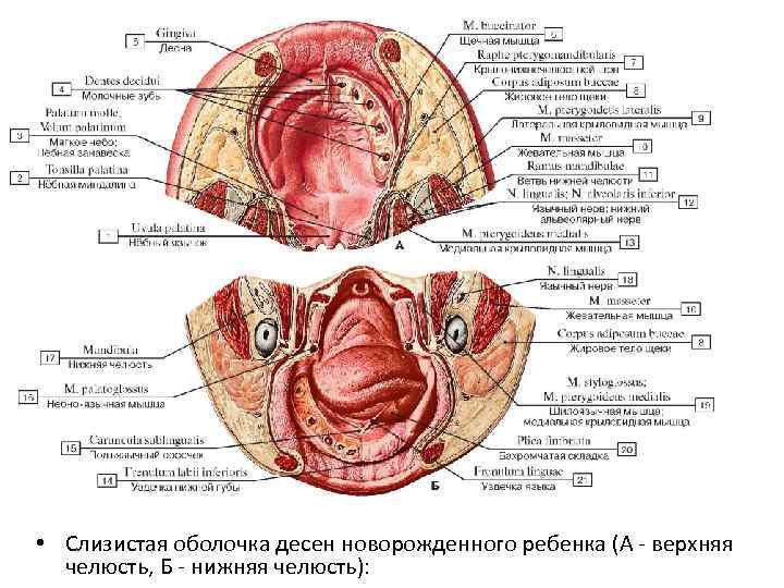  • Слизистая оболочка десен новорожденного ребенка (А - верхняя челюсть, Б - нижняя