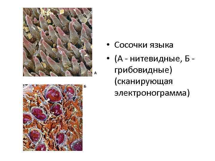  • Сосочки языка • (А - нитевидные, Б грибовидные) (сканирующая электронограмма) 