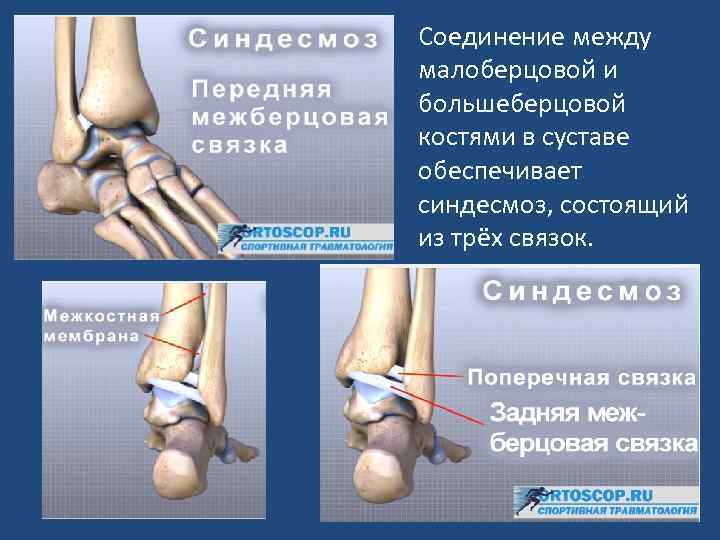 Соединение между малоберцовой и большеберцовой костями в суставе обеспечивает синдесмоз, состоящий из трёх связок.