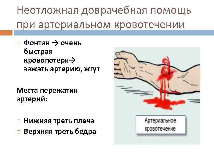 Неотложная доврачебная помощь при артериальном кровотечении Фонтан → очень быстрая кровопотеря→ зажать артерию, жгут
