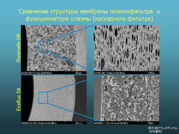 Evaflux 5 A Plasmaflo OP Сравнение структуры мембраны плазмофильтра и фракционатора плазмы (каскадного фильтра)