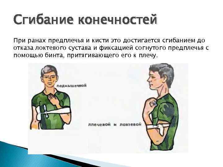 Сгибание конечностей При ранах предплечья и кисти это достигается сгибанием до отказа локтевого сустава