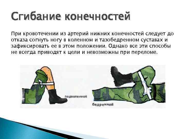 Сгибание конечностей При кровотечении из артерий нижних конечностей следует до отказа согнуть ногу в