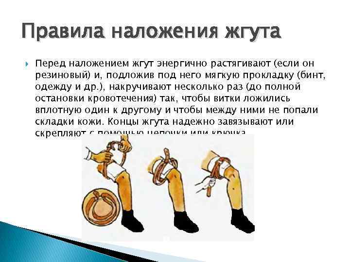 Правила наложения жгута Перед наложением жгут энергично растягивают (если он резиновый) и, подложив под