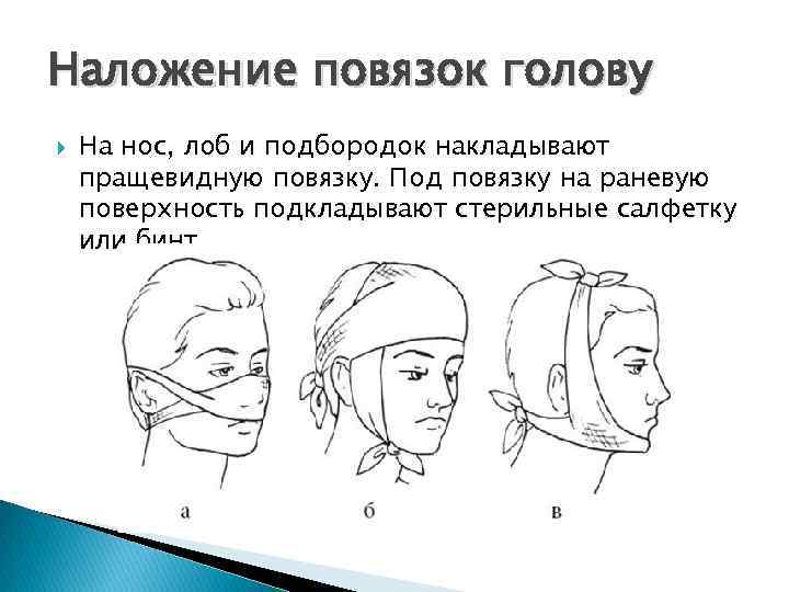 Наложение повязок голову На нос, лоб и подбородок накладывают пращевидную повязку. Под повязку на