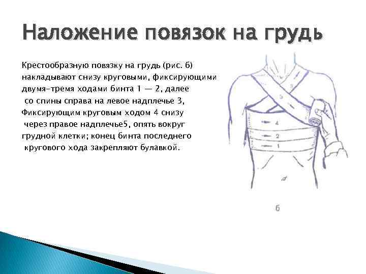 Наложение повязок на грудь Крестообразную повязку на грудь (рис. б) накладывают снизу круговыми, фиксирующими