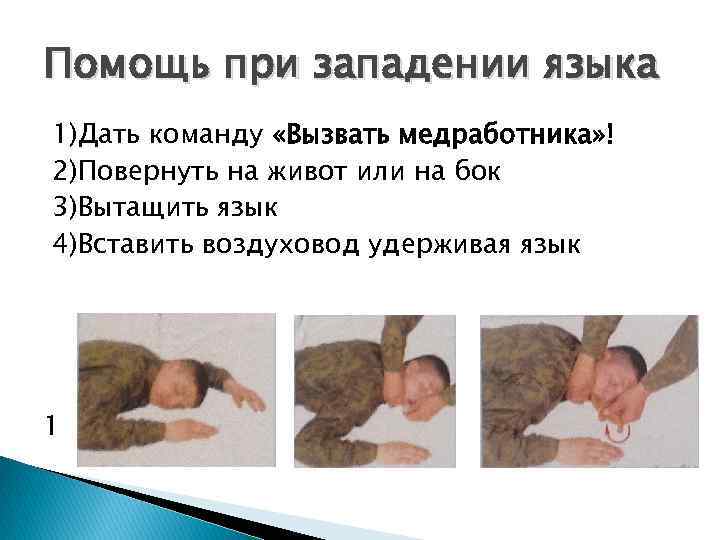 Помощь при западении языка 1)Дать команду «Вызвать медработника» ! 2)Повернуть на живот или на