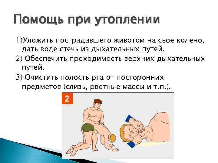 Помощь при утоплении 1)Уложить пострадавшего животом на свое колено, дать воде стечь из дыхательных