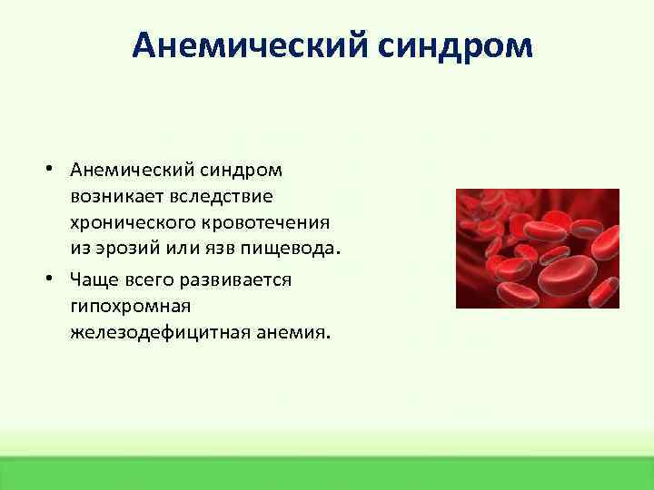 Анемический синдром • Анемический синдром возникает вследствие хронического кровотечения из эрозий или язв пищевода.