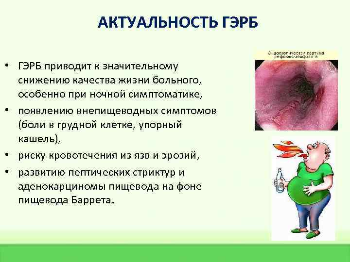 АКТУАЛЬНОСТЬ ГЭРБ • ГЭРБ приводит к значительному снижению качества жизни больного, особенно при ночной