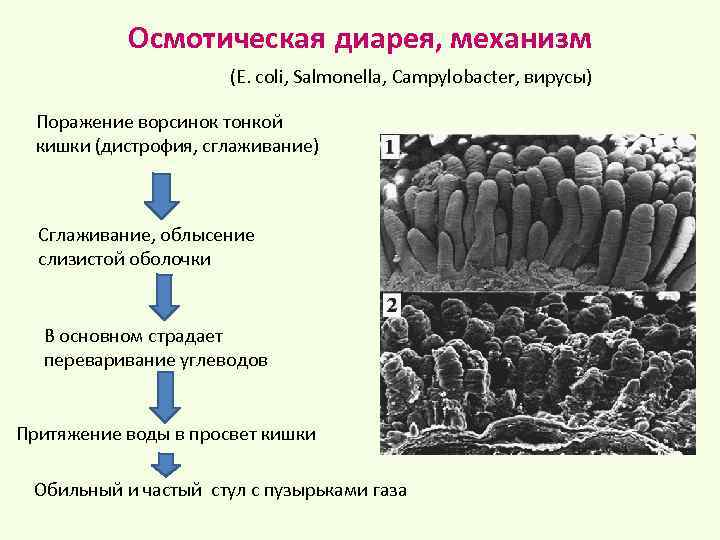 Осмотическая диарея, механизм (E. coli, Salmonella, Campylobacter, вирусы) Поражение ворсинок тонкой кишки (дистрофия, сглаживание)