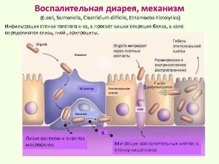 Воспалительная диарея, механизм (E. coli, Salmonella, Clostridium difficile, Entamoeba histolytica) Инфильтрация стенки толстого к-ка,